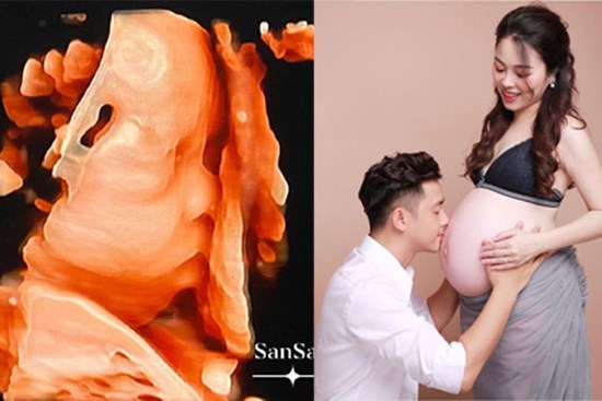 Hot mom Hằng Túi sát ngày sinh con thứ 5 mới bật mí ảnh siêu âm, nguyên nhân tưởng khó hiểu nhưng lại rất thuyết phục