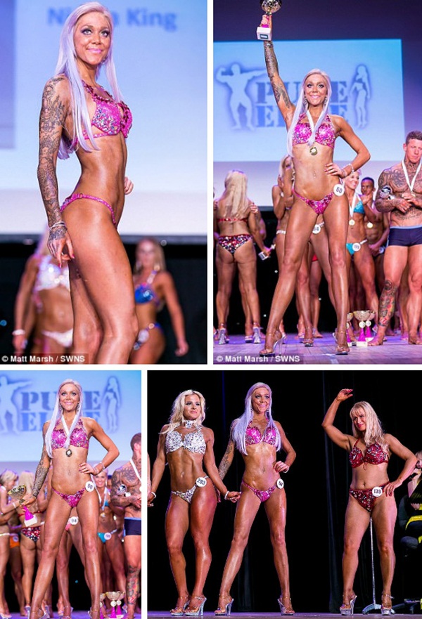 Cô gái bị ví như bộ xương di động, yếu đến mức bác sĩ khuyên gia đình chuẩn bị tâm lý vĩnh biệt, 18 tháng sau điều kỳ diệu đã xảy ra-5