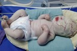 Bác sĩ chỉ ra những hành vi bà bầu cần tránh xa nếu không muốn sinh con ra có những vết bớt xấu xí trên người-3