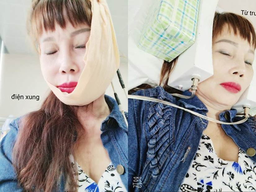 Cô dâu Thu Sao tiết lộ: May chị đi khám, bác sĩ nói để lâu là méo miệng cả đời”-1