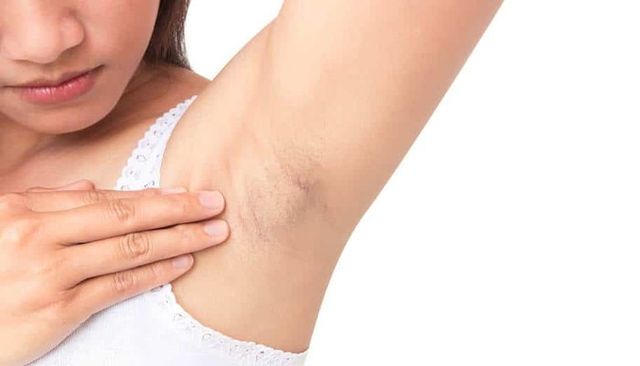 Bất kể đàn ông hay phụ nữ, 3 vị trí này càng nhiều lông thì tuổi thọ càng dài-2
