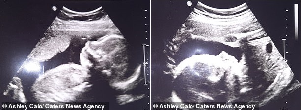 Đi siêu âm ở tuần thứ 8, cặp vợ chồng sốc đến rớt hàm khi nghe thông báo của bác sĩ về thai nhi-1