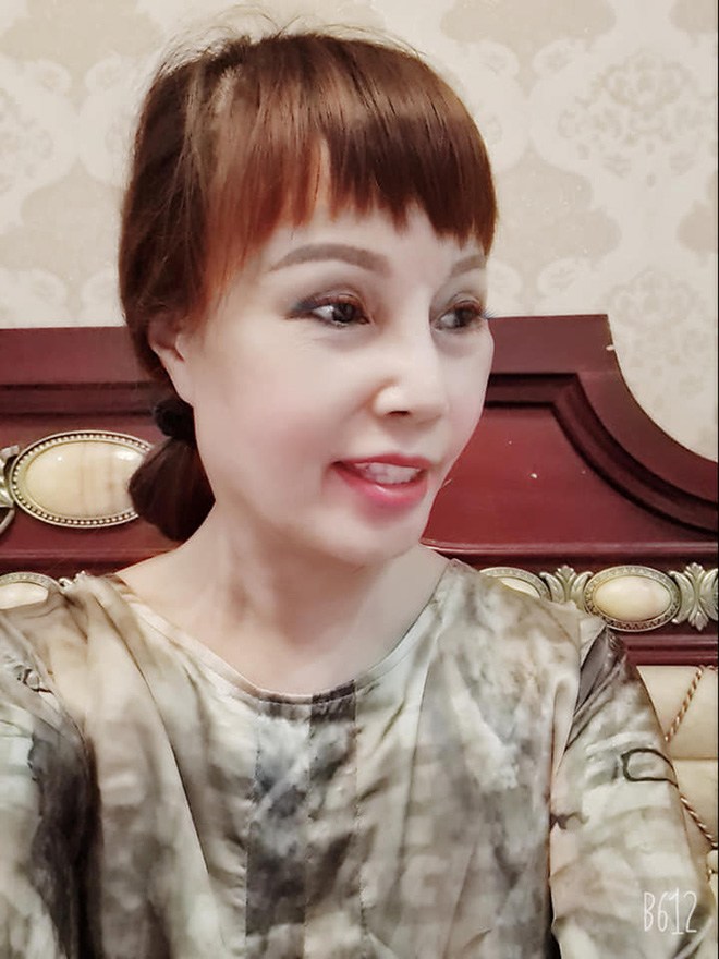 Cô dâu Thu Sao tiếp tục gây choáng váng với nhan sắc lạ mặc dù đang điều trị méo miệng-1