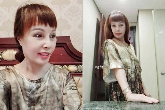Cô dâu Thu Sao tiếp tục gây choáng váng với nhan sắc lạ mặc dù đang điều trị méo miệng