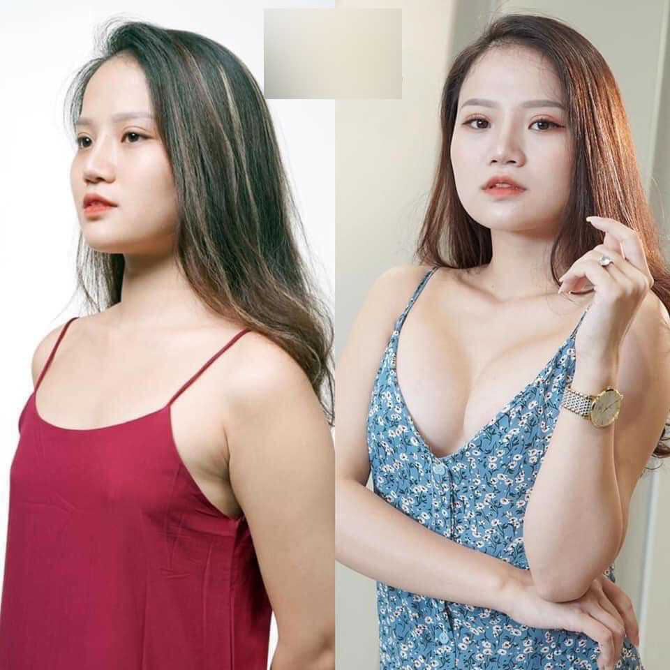 Nhan sắc cũ của nữ diễn viên sinh năm 1999 với vòng 1 bức tử bị đánh ghen trên phố Tô Hiệu được đào mộ-6