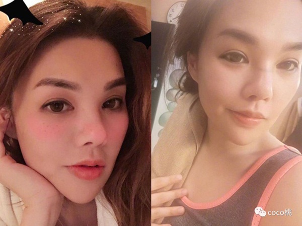 Ái nữ nhà tài phiệt Hồng Kông bất ngờ tử vong khi phẫu thuật thẩm mỹ tại Hàn Quốc, tiết lộ gây sốc về nguyên nhân xảy ra sự cố-1