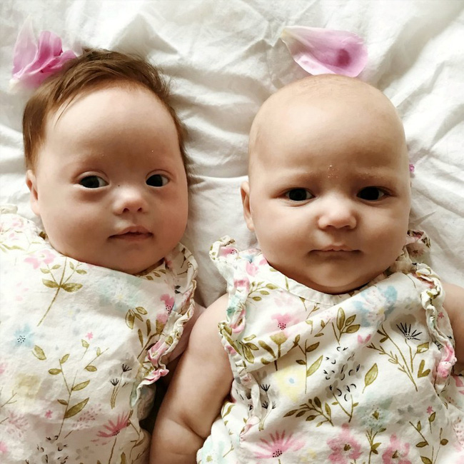 Vừa trao con cho bà mẹ mới sinh, bác sĩ đã phải cúi đầu xin lỗi vì một sai sót nghiêm trọng trong quá trình siêu âm-1