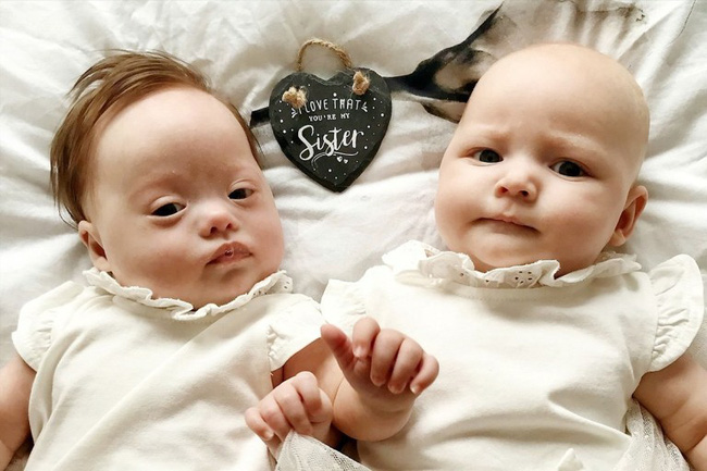 Vừa trao con cho bà mẹ mới sinh, bác sĩ đã phải cúi đầu xin lỗi vì một sai sót nghiêm trọng trong quá trình siêu âm-2
