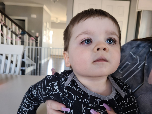 Mẹ hoảng loạn tột độ khi con trai suýt bị mất đi thị lực bởi món đồ chơi quá đỗi quen thuộc, hầu như bé nào cũng có-6