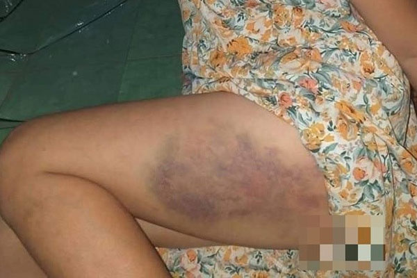 Con trai tôi đi học về rơm rớm nước mắt bảo: Mẹ đến nhà cô tặng quà đi, mấy hôm nay con thấy thái độ của cô khác lắm-3