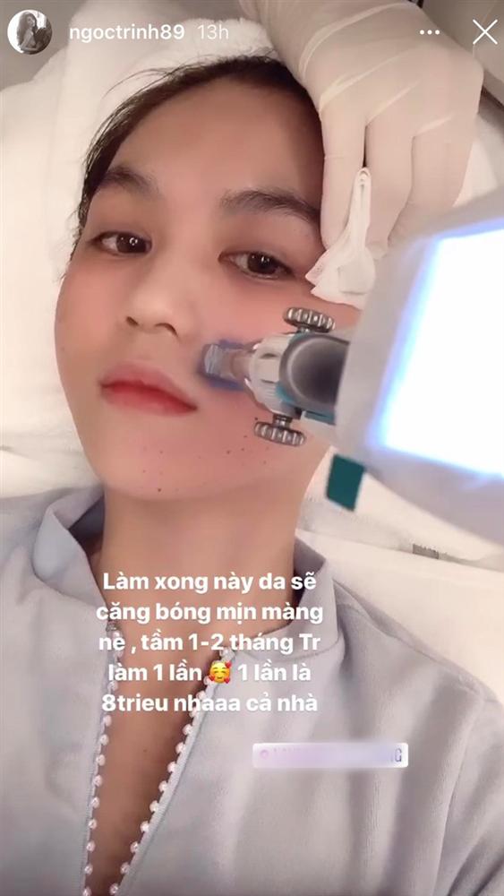 Ngọc Trinh chi 8 triệu để cấy tinh chất vào da, Hà Hồ chịu chi với phương pháp tiêm tế bào gốc được chiết xuất từ mỡ của chính chủ-1