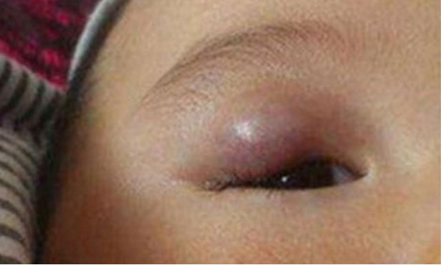 Việc cắt lông mi cho trẻ có tác hại như thế nào? Hầu hết các mẹ đều hối hận khi đọc xong-2