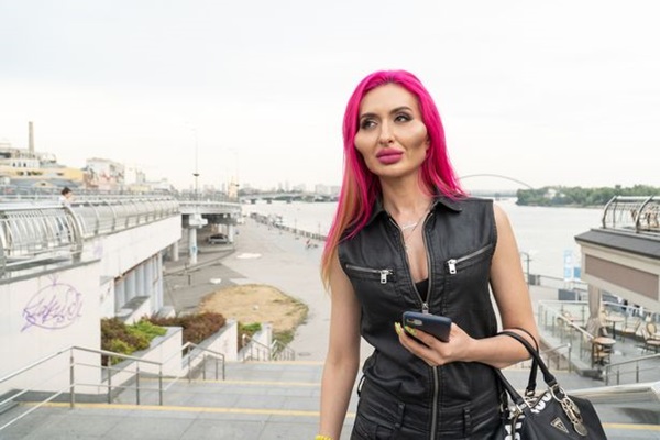 Bỏ gần 5 chục triệu tự tiêm filler, người mẫu Instagram có đôi má bự nhất thế giới bảo vẫn nhỏ lắm chưa ăn thua-4