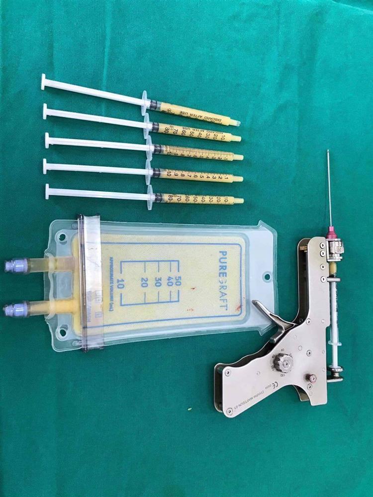 Tiêm mỡ tự thân làm đẹp, cô gái Hà Thành phải rạch mặt sưng nề để nặn ổ mủ-2
