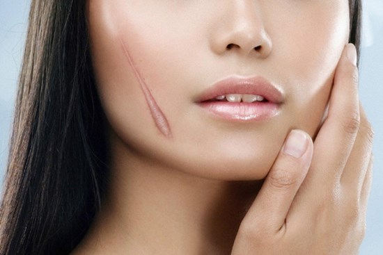 Nếu không muốn bị chê kém xinh, các chị hãy thuộc nằm lòng đáp án cho câu hỏi 