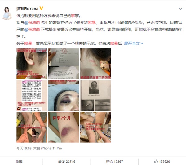 Vợ VĐV điền kinh nổi tiếng tố chồng ngoại tình và bạo hành gia đình, người chồng bình thản trả lời: VĐV đều như vậy, do hormone nam quá cao-2