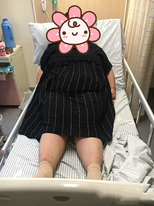 Khổ sở vạch lớp mỡ dày mổ đẻ cho 9X tạ rưỡi, đứa trẻ ra đời bác sĩ thở dài-1