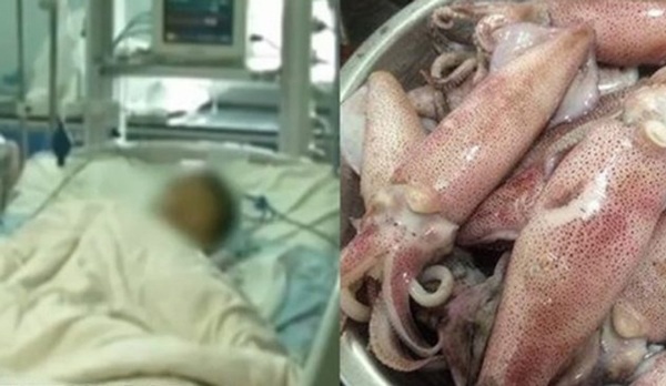 Ăn mực cất trong tủ lạnh 6 ngày, bé trai 11 tuổi có nguy cơ phải chạy thận suốt đời-1