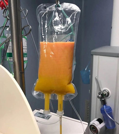 Thèm gà rán đòi chồng mua về ăn, mẹ bầu nhập viện bác sĩ đẩy ngay đi cấp cứu-2