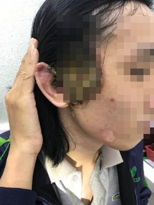 Số người khám bệnh lây qua đường tình dục ở BV Da liễu TP.HCM tăng cao-2