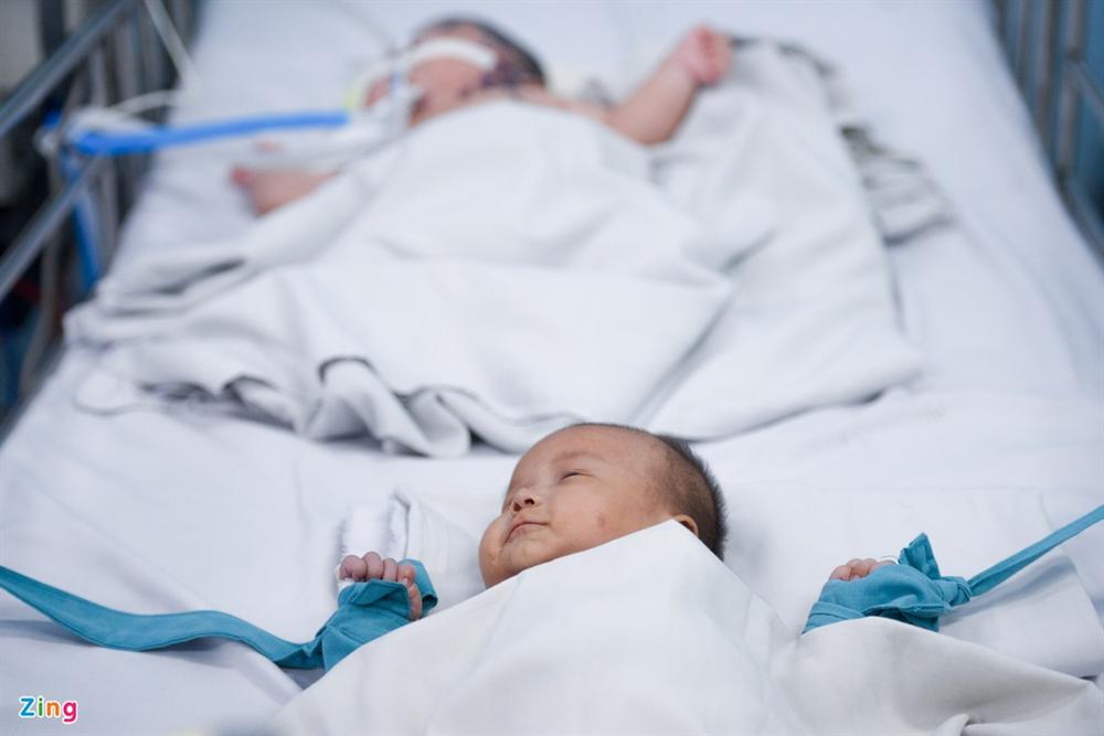 Bệnh viện ở TP.HCM đông nghẹt trẻ bị tay chân miệng-3