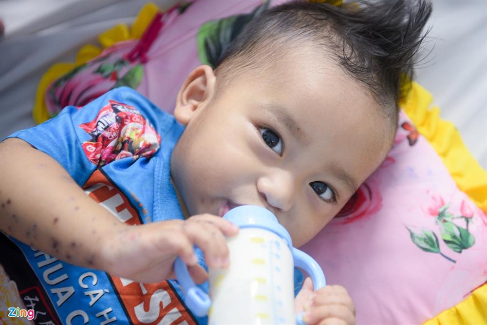 Bệnh viện ở TP.HCM đông nghẹt trẻ bị tay chân miệng-5