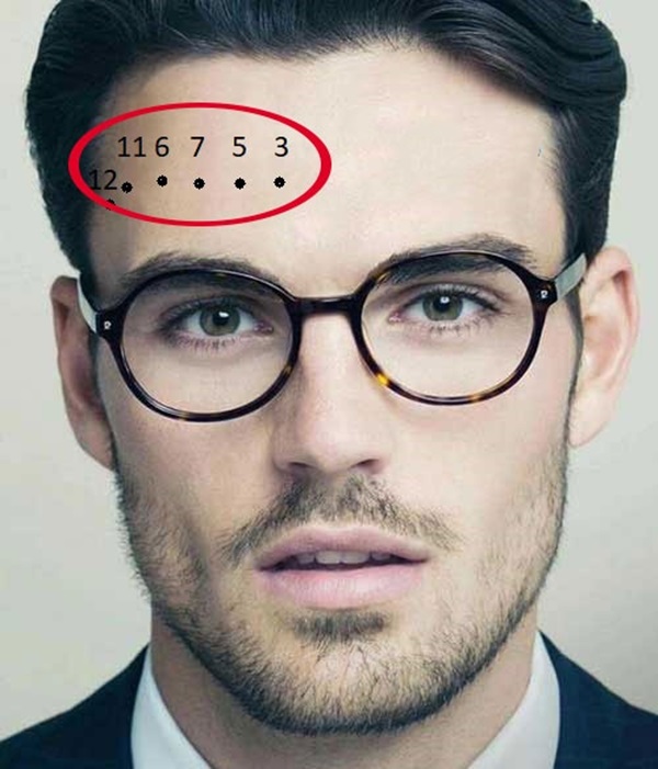 Nốt ruồi ở trán, là họa hay là phúc?-3