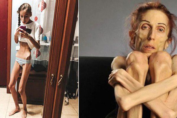 Cuộc đời rùng rợn của cặp song sinh không nói tiếng người, người này sống thì người kia phải chết-7