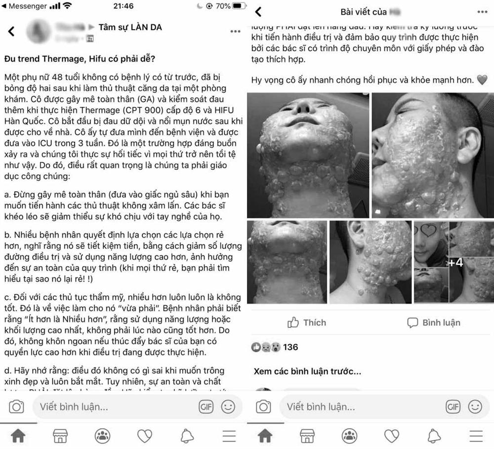 Đầu tư tiền làm trẻ hóa căng da, người phụ nữ bị bỏng rộp hết khuôn mặt-1