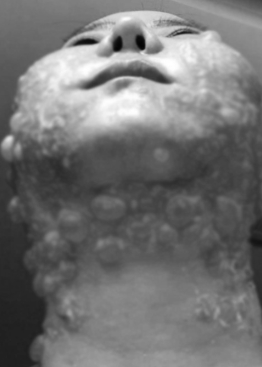 Đầu tư tiền làm trẻ hóa căng da, người phụ nữ bị bỏng rộp hết khuôn mặt-4