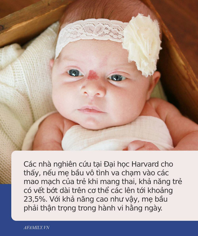 Bác sĩ chỉ ra những hành vi bà bầu cần tránh xa nếu không muốn sinh con ra có những vết bớt xấu xí trên người-2