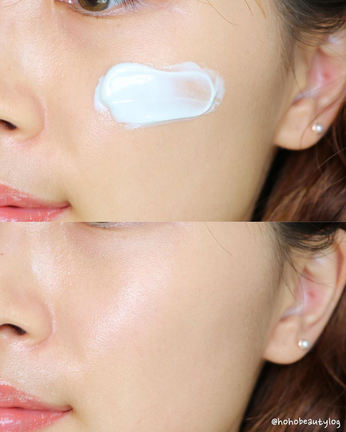 Mụn nổi hoài không hết là do bạn skincare lệch pha”, biết sớm những sai lầm sau mới mong cứu được làn da-3