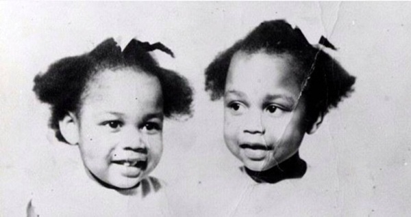 Cuộc đời rùng rợn của cặp song sinh không nói tiếng người, người này sống thì người kia phải chết-1