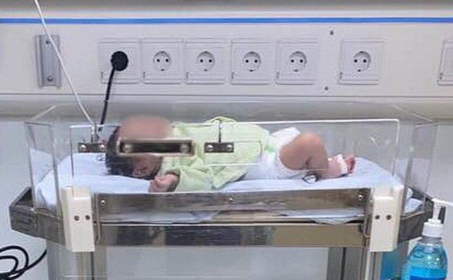 Mẹ ngàn lần xin lỗi con, tại mẹ chủ quan không giữ gìn con của mẹ: Cảnh báo của bà mẹ trẻ khiến nhiều người xót xa-1