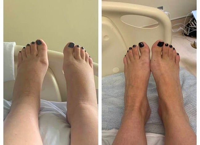 Không thể tin đây là vòng 2 của các mẹ sau khi sinh, thế mới biết cơ thể phụ nữ bị tàn phá nặng nề thế nào từ khi có con-13