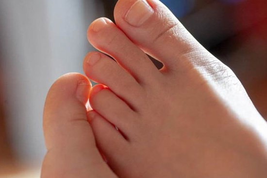 Bỗng dưng thấy bàn chân thay đổi theo 3 cách này, coi chừng bệnh ung thư đang phát triển trong cơ thể, cần lập tức đi khám