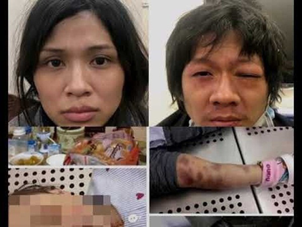 Bản tính ác độc và bệnh hoạn của cặp vợ chồng bạo hành con gái 3 tuổi đến chết-1