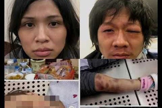 Bản tính ác độc và bệnh hoạn của cặp vợ chồng bạo hành con gái 3 tuổi đến chết