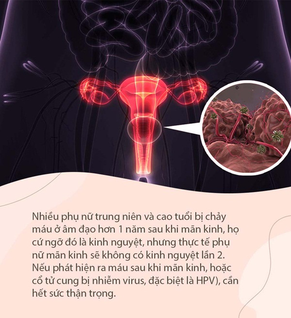 Người phụ nữ phát hiện bị ung thư cổ tử cung bởi một bất thường sau khi mãn kinh mà cũng rất nhiều người hay bỏ qua-2