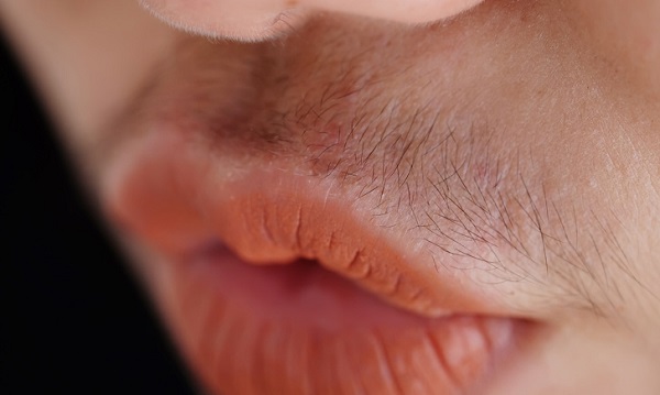 Người phụ nữ dễ mắc bệnh phụ khoa, tử cung yếu thường sẽ có 3 đặc điểm ở miệng-3