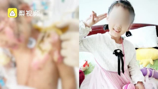 Địa ngục trần gian: Bé gái 6 tuổi bị mẹ ruột cùng bạn trai bạo hành dã man 3 tháng trời, bố đẻ gặp lại cũng không nhận ra con mình-1