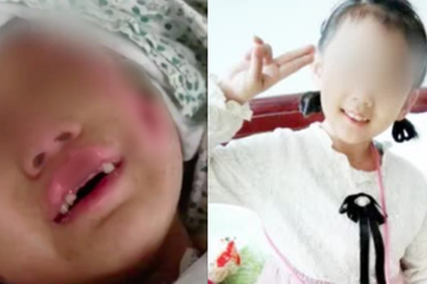 Vụ bé gái 6 tuổi bị mẹ ruột và nhân tình bạo hành: Lời kể của bố ruột gây đau lòng, luật sư khẳng định Vụ việc tàn khốc nhất!-5