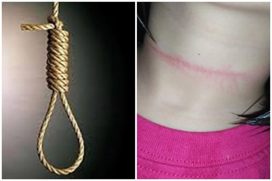 Bé gái 4 tuổi suýt mất mạng khi cố treo cổ tự tử theo một thử thách trên Tiktok