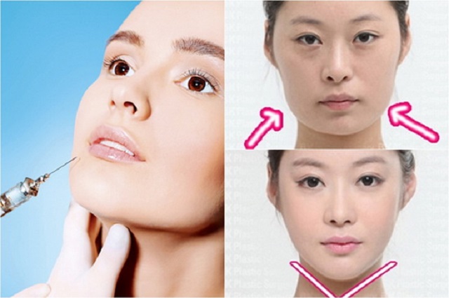 Hà Nội: Tiêm botox vào bụng và bắp tay để có vóc dáng đẹp, một phụ nữ phải vào bệnh viện cấp cứu-1