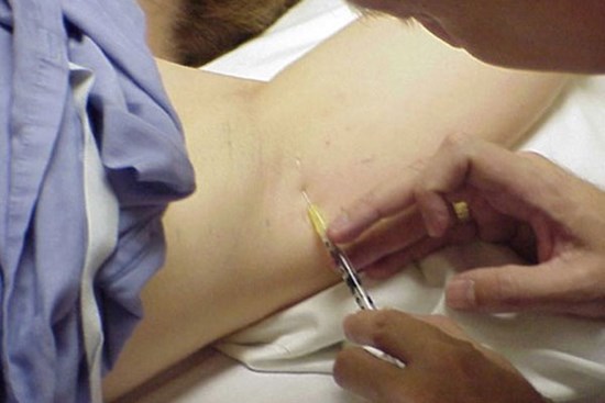 Hà Nội: Tiêm botox vào bụng và bắp tay để có vóc dáng đẹp, một phụ nữ phải vào bệnh viện cấp cứu
