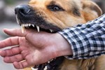 Kinh hoàng: Chó Pitbull gần 60kg cắn chết người trong quán cà phê, chủ ngăn cản cũng bị cắn trọng thương-2