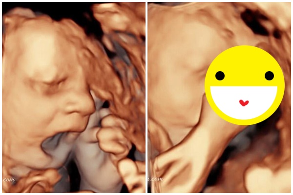 Đẻ sinh đôi nhưng bố chỉ chăm chăm bế nựng con gái, vẻ mặt ai oán của cậu con trai khiến người xem cười nghiêng ngả-6