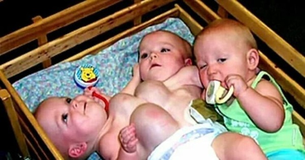 Ca sinh ba đặc biệt có 2 bé dính liền, chào đời với cân nặng chưa đầy 1kg đã bị mẹ bỏ rơi và 16 năm sau nhìn lại ai cũng mỉm cười-1