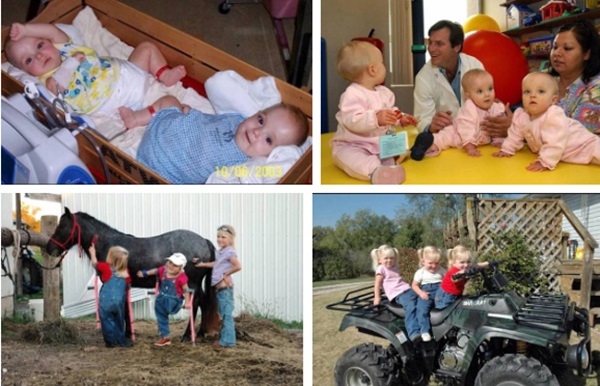 Ca sinh ba đặc biệt có 2 bé dính liền, chào đời với cân nặng chưa đầy 1kg đã bị mẹ bỏ rơi và 16 năm sau nhìn lại ai cũng mỉm cười-6