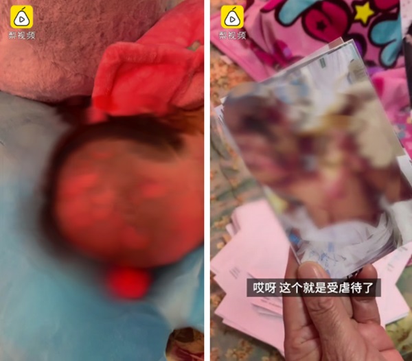 Vụ bé gái 6 tuổi bị mẹ ruột và nhân tình bạo hành: Lời kể của bố ruột gây đau lòng, luật sư khẳng định Vụ việc tàn khốc nhất!-2